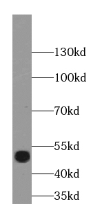 anti- BRN2-Specific antibody