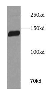 anti- Brevican antibody