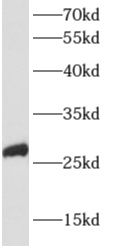      anti- APOBEC2 antibody