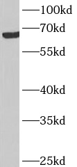 anti- ANKRD53 antibody