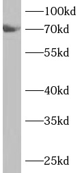 anti- ANKS1B antibody