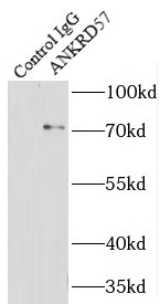 anti- ANKRD57 antibody