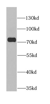 anti- ANTXR2 antibody