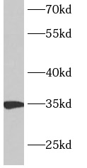      anti- ANKRD54 antibody