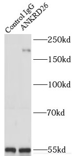      anti- ANKRD26 antibody