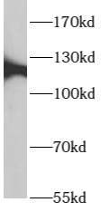      anti- ARHGEF18 antibody