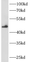 anti- ANKRD33 antibody