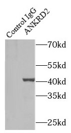 anti- ANKRD2 antibody