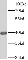 anti- ANKRD2 antibody