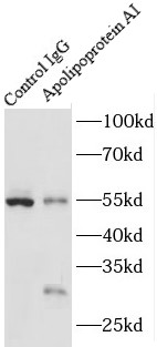      anti- Apolipoprotein AI antibody