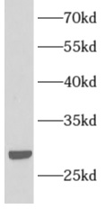      anti- Apolipoprotein AI antibody