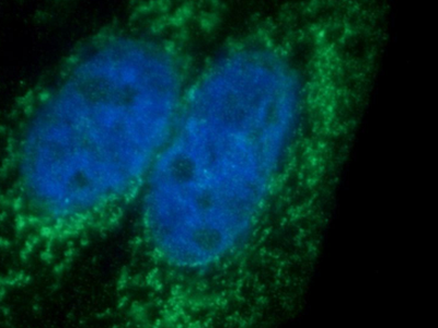      anti- AMPK alpha 1 antibody