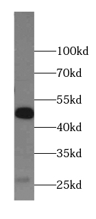      anti- Antizyme inhibitor 1 antibody