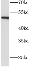 Antithrombin III抗体