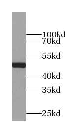 anti- Apolipoprotein H antibody