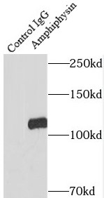      anti- Amphiphysin antibody