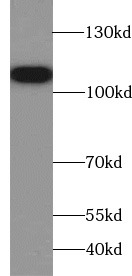      anti- Amphiphysin antibody