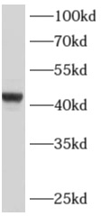      anti- ADAMDEC1 antibody