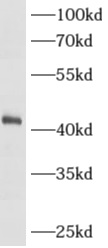      anti- AMACR/p504S antibody