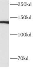      anti- ALPK1 antibody