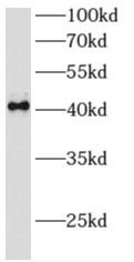 anti- AMZ2 antibody