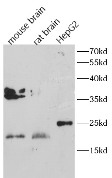      anti- ALR antibody