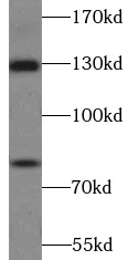 anti- AMOT antibody