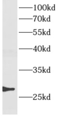      anti- AMN1 antibody