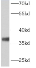      anti- ALG5 antibody