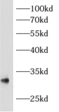      anti- AMZ1 antibody