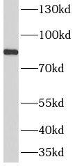 anti- AMPD3 antibody