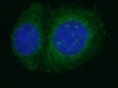      anti- AMH antibody