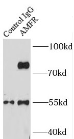 anti- AMFR antibody