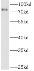 anti- AMFR antibody