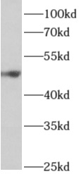 anti- ALDH5A1 antibody