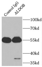      anti- ALDOB antibody