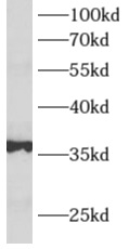      anti- ALDOB antibody