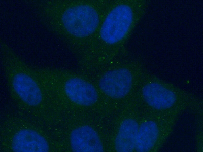      anti- ALDH8A1 antibody