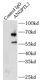      anti- ANGPTL2 antibody