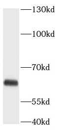      anti- ANGPTL2 antibody