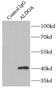      anti- ALDOA antibody