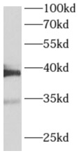      anti- ALDOA antibody