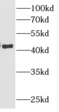 anti- AMMECR1 antibody