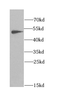      anti- ANGPTL3 antibody