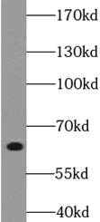      anti- ANKLE1 antibody