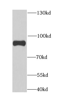 anti- ANAPC5 antibody