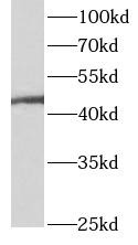      anti- ANGPTL5 antibody