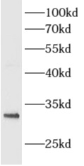      anti- ALKBH3 antibody