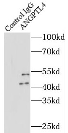 ANGPTL4抗体
