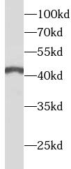      anti- ANGPTL4 antibody